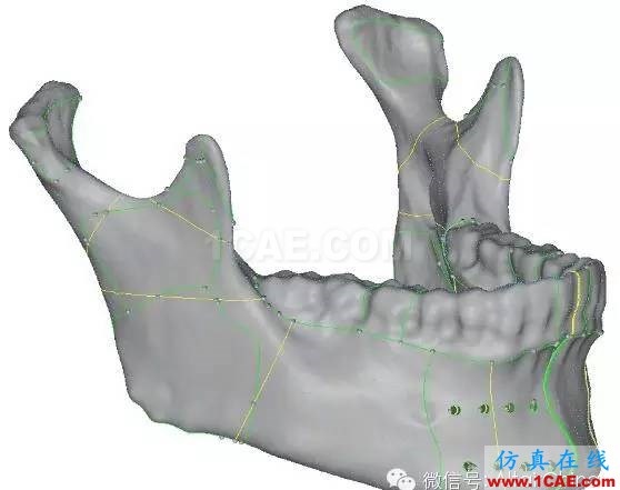 Hypermesh 2015 CAE 有限元網(wǎng)格競(jìng)賽作品案例hypermesh分析圖片10