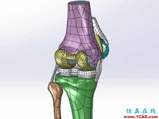 【醫(yī)學應用】骨科知識和有限元分析ansys圖片4