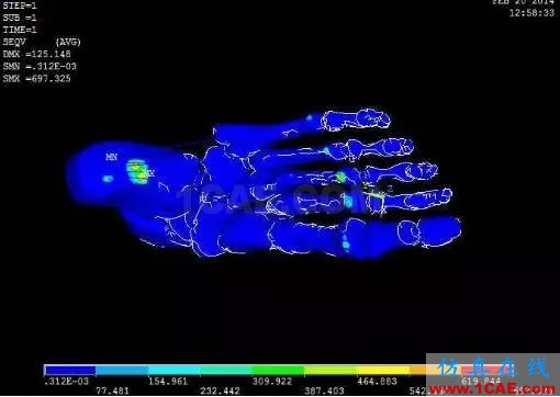 奚夢(mèng)瑤維密第一摔與有限元仿真ansys結(jié)果圖片9